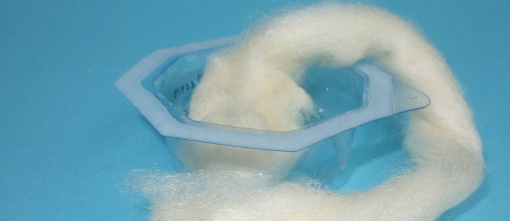 durchsichtige Schale, aus der das Alginat wie herausgezogene Watte ragt