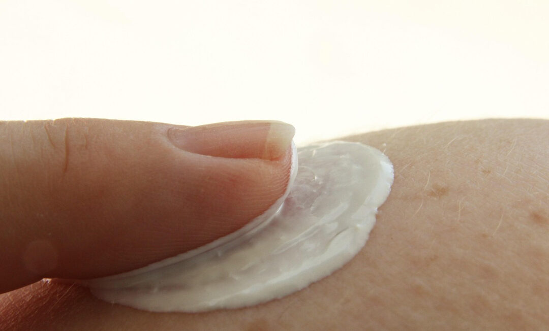 Ein Finger cremt ein Stück Haut ein. Die Personen selbst sind nicht zu sehen.