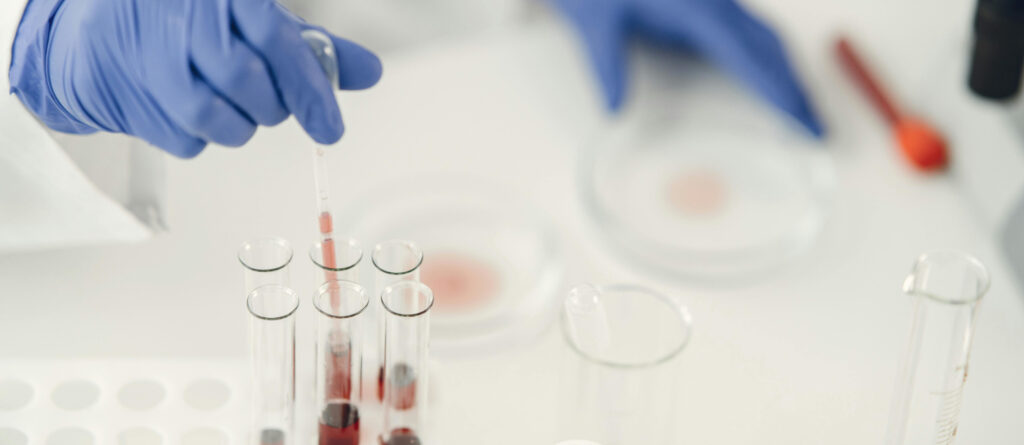 Behandschuhte Hände, die mit einer Pipette etwas aus einem Reagenzglas entnehmen, um es in der benachbarten Petri-Schale zu platzieren.