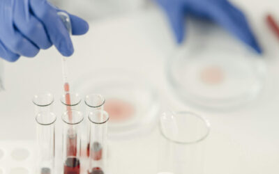 Postoperative Infektionen mit multiresistenten Erregern sicher managen