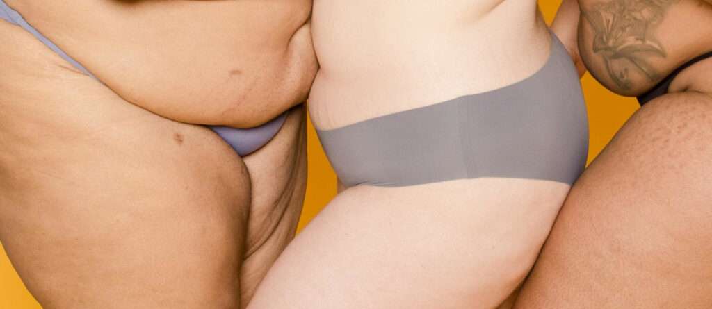 Drei adipöse Frauen in Slips stehen dicht nebeneinander. Zu sehen sind sie nur vom Oberschenkel bis knapp über den Bauchnabel. Bei den außenstehenden Frauen sieht man deutlich die "Fettschlappe"