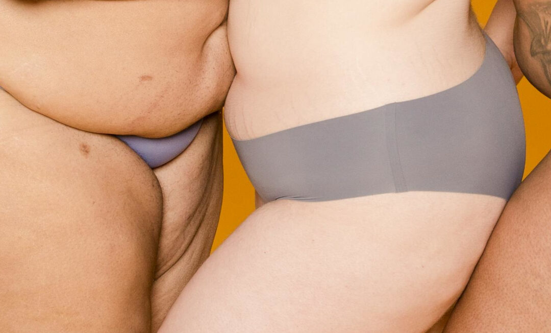 Drei adipöse Frauen in Slips stehen dicht nebeneinander. Zu sehen sind sie nur vom Oberschenkel bis knapp über den Bauchnabel. Bei den außenstehenden Frauen sieht man deutlich die "Fettschlappe"